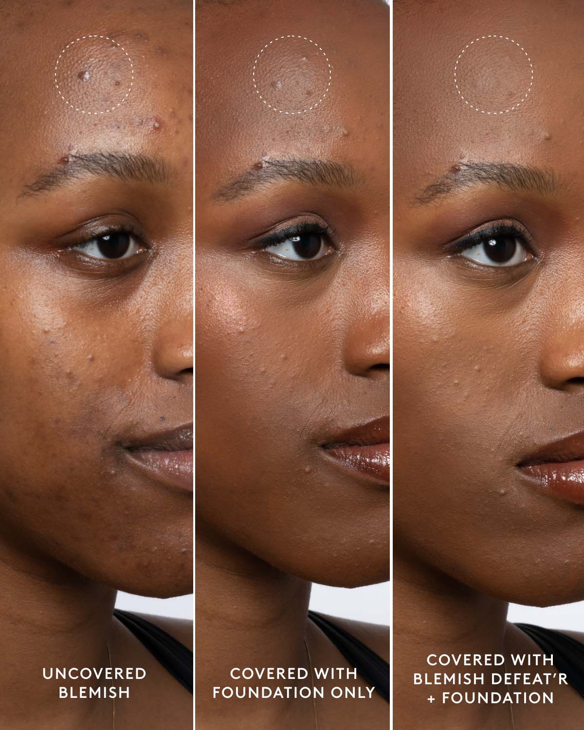 Blemish Defeat'r BHA Spot-Targeting Gel - Image 9