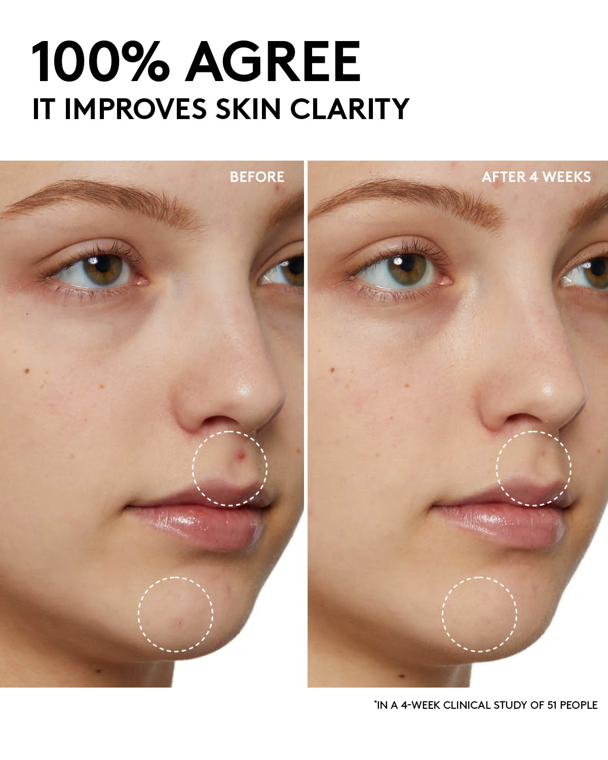 Cherry Dub Pore Purify'r Gel Cleanser with Niacinamide + Aloe Juice - Image 4