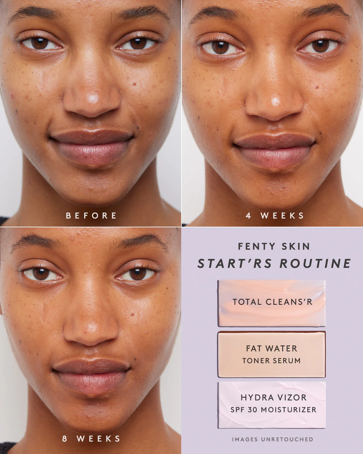 Fenty Skin Start’rs Full-Size Bundle with Mineral SPF - Image 3