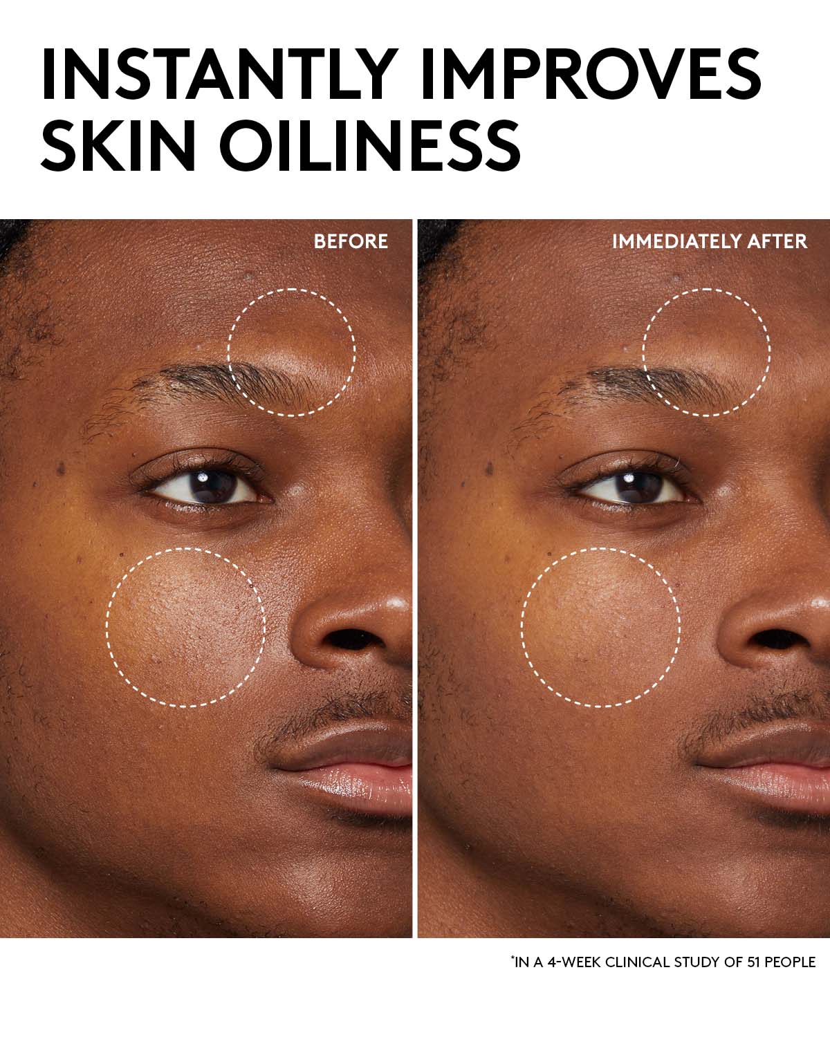 Fenty Skin Start’rs Full-Size Bundle with Mineral SPF: Oily Skin Edition - Image 12