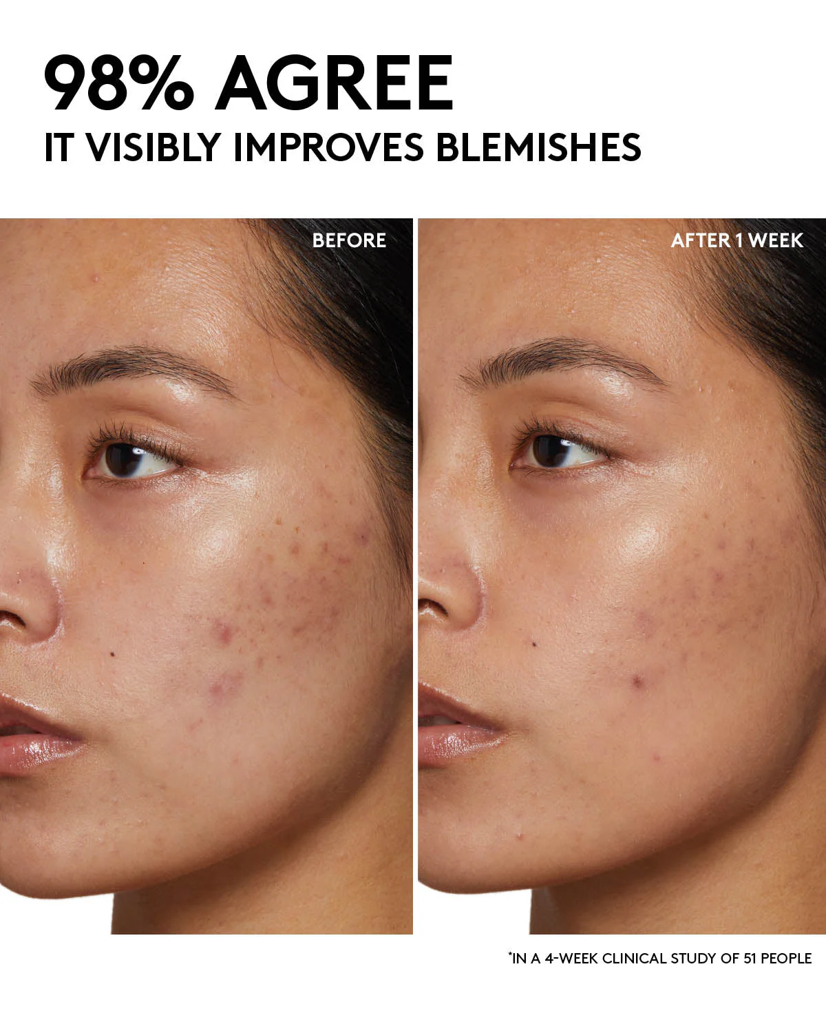 Fenty Skin Start’rs Full-Size Bundle with Mineral SPF: Oily Skin Edition - Image 14