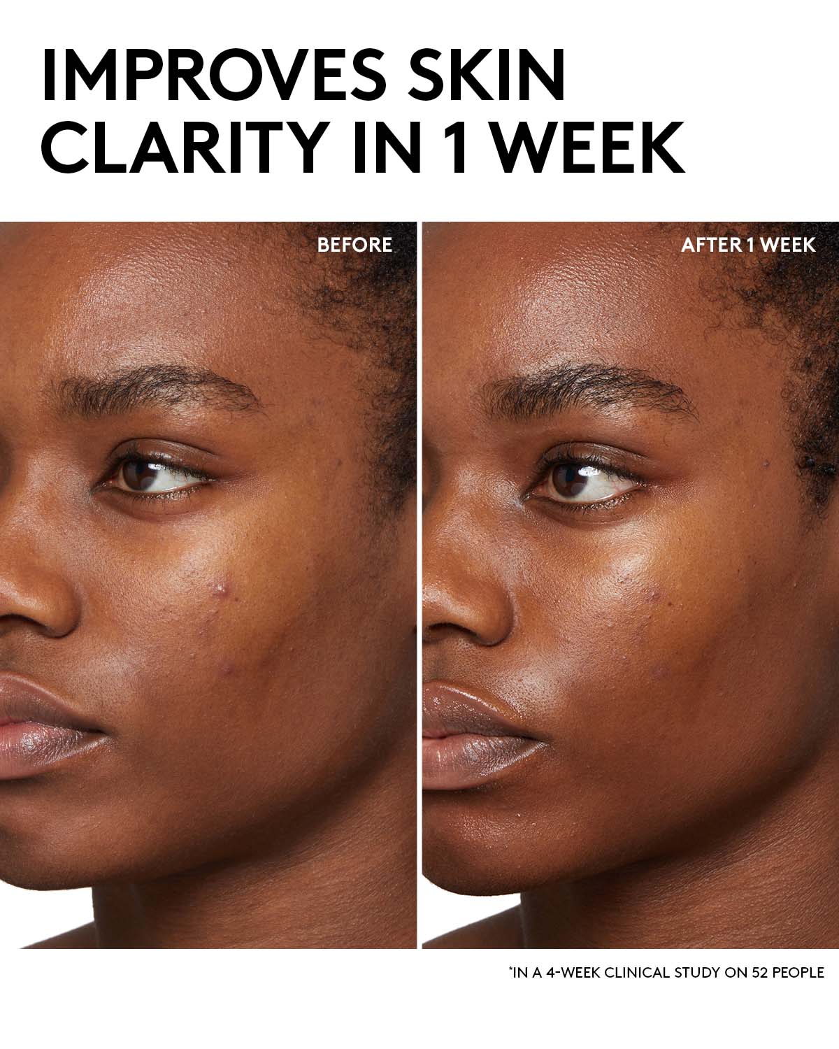 Fenty Skin Start’rs Full-Size Bundle with Mineral SPF: Oily Skin Edition - Image 3