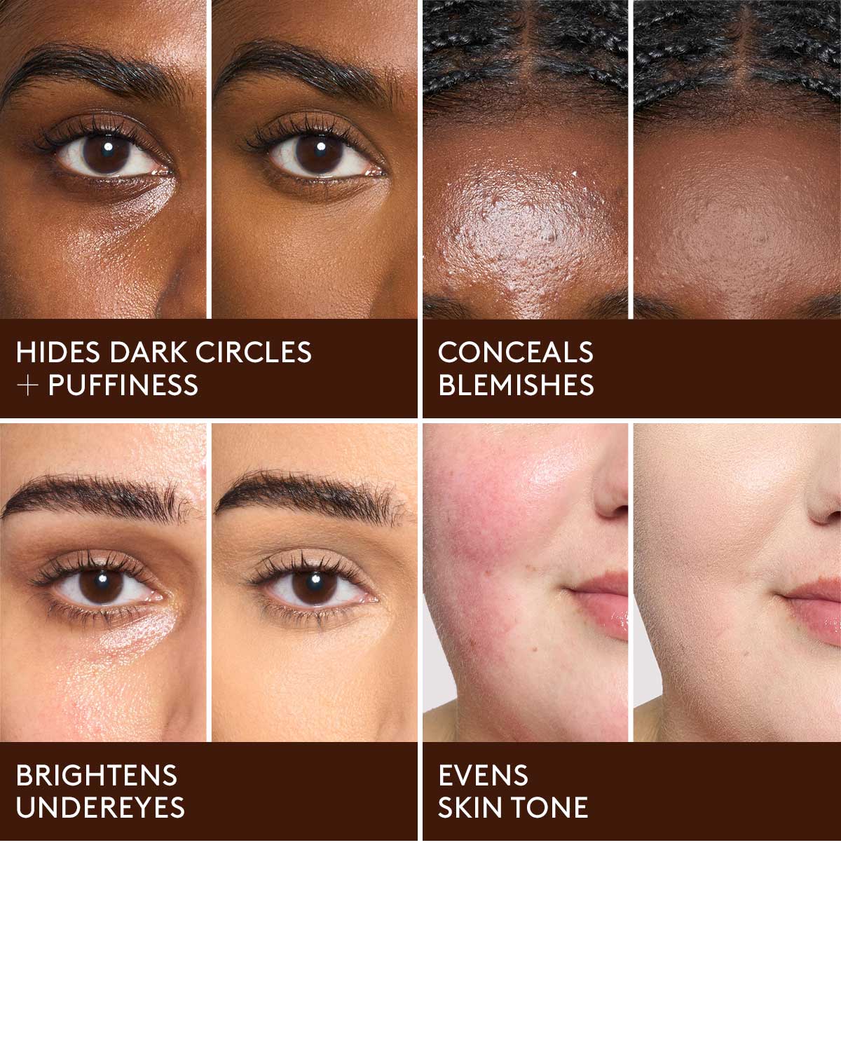 Instant Retouch Essentials Bundle - Image 5